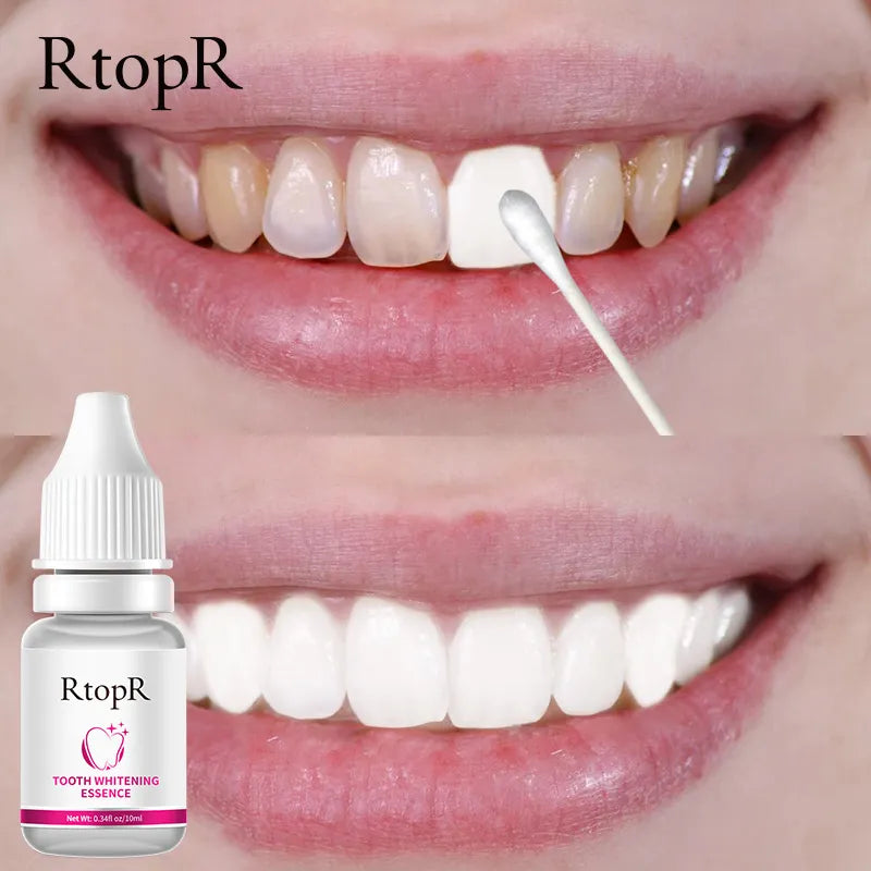 RtopR Teeth Whitening Essence Brightens Teeth Removes Plaque