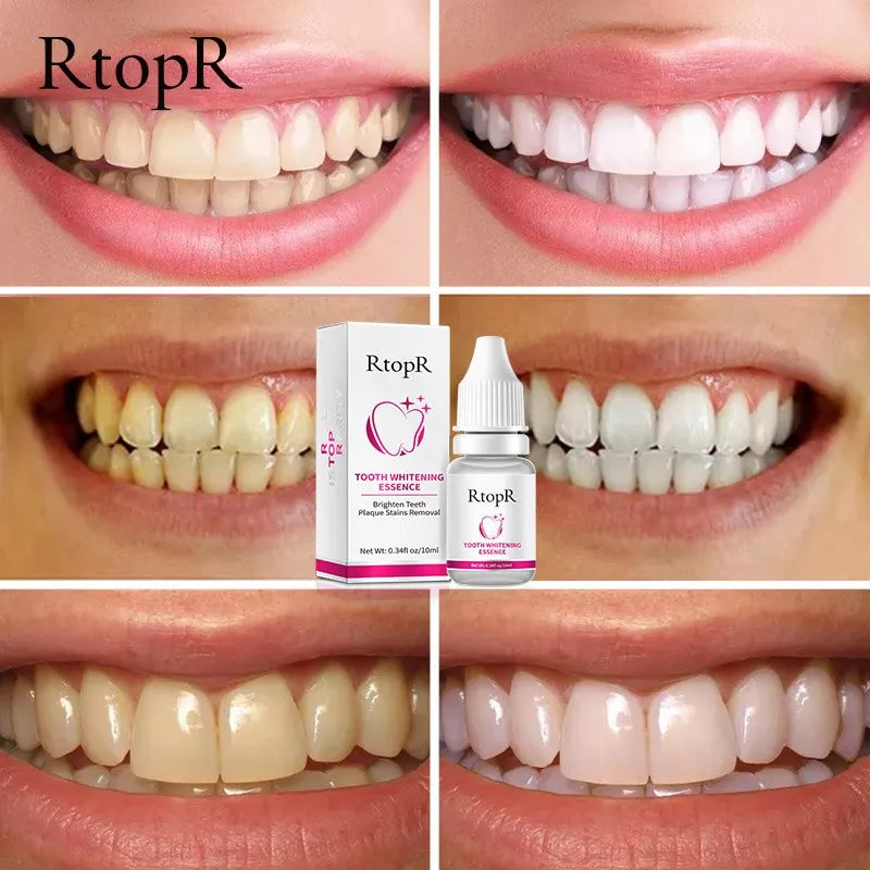 RtopR Teeth Whitening Essence Brightens Teeth Removes Plaque